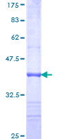 12.5% SDS-PAGE Stained with Coomassie Blue.
